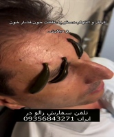 زالودرمانی عفونت گوش و گزگز و التهاب دست و پا