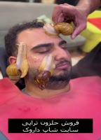 حلزون تراپی کلاژن سازی پوست